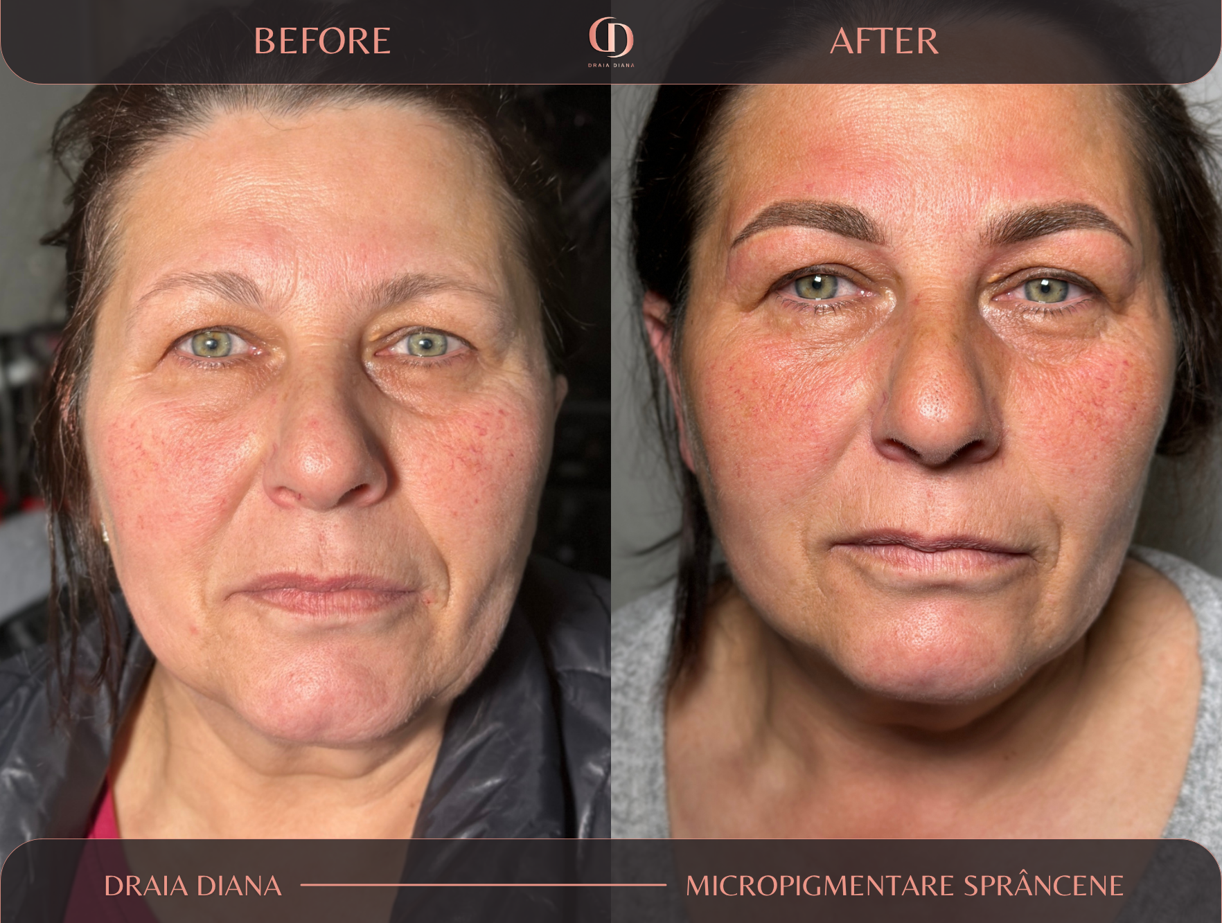 Micropigmentare-Sprancene-Draia-Diana-Beauty-Studio-Cluj-Apahida