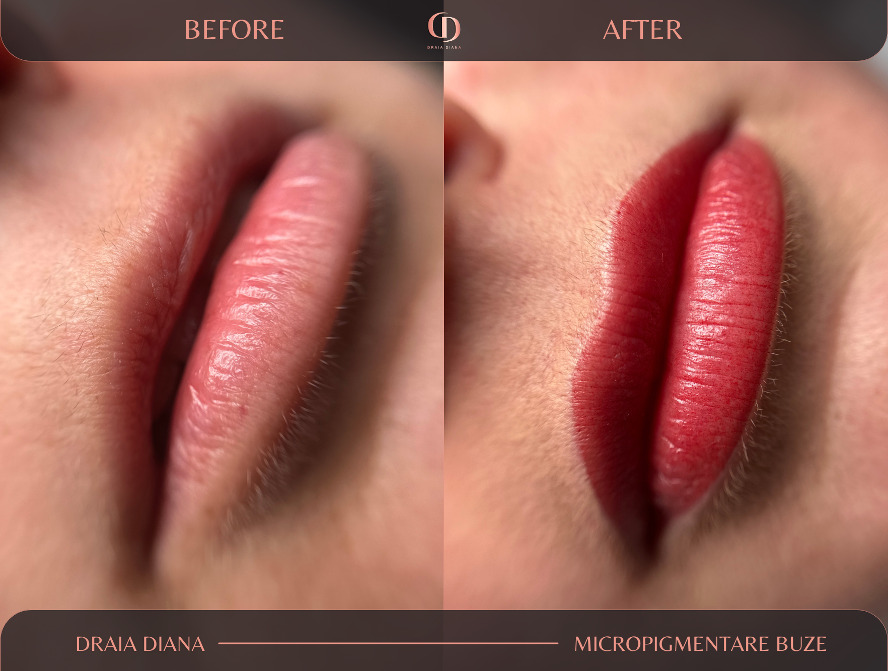 Micropigmentare-buze-ba-1.png