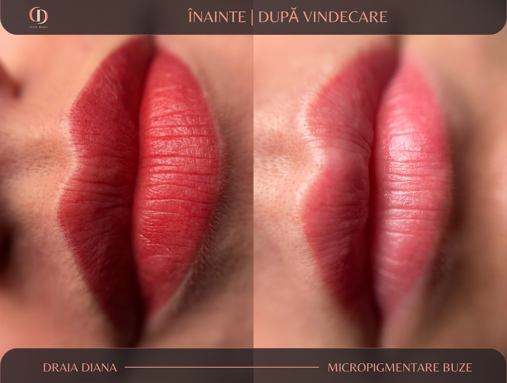 Micropigmentare Buze Apahida Cluj | Draia Diana