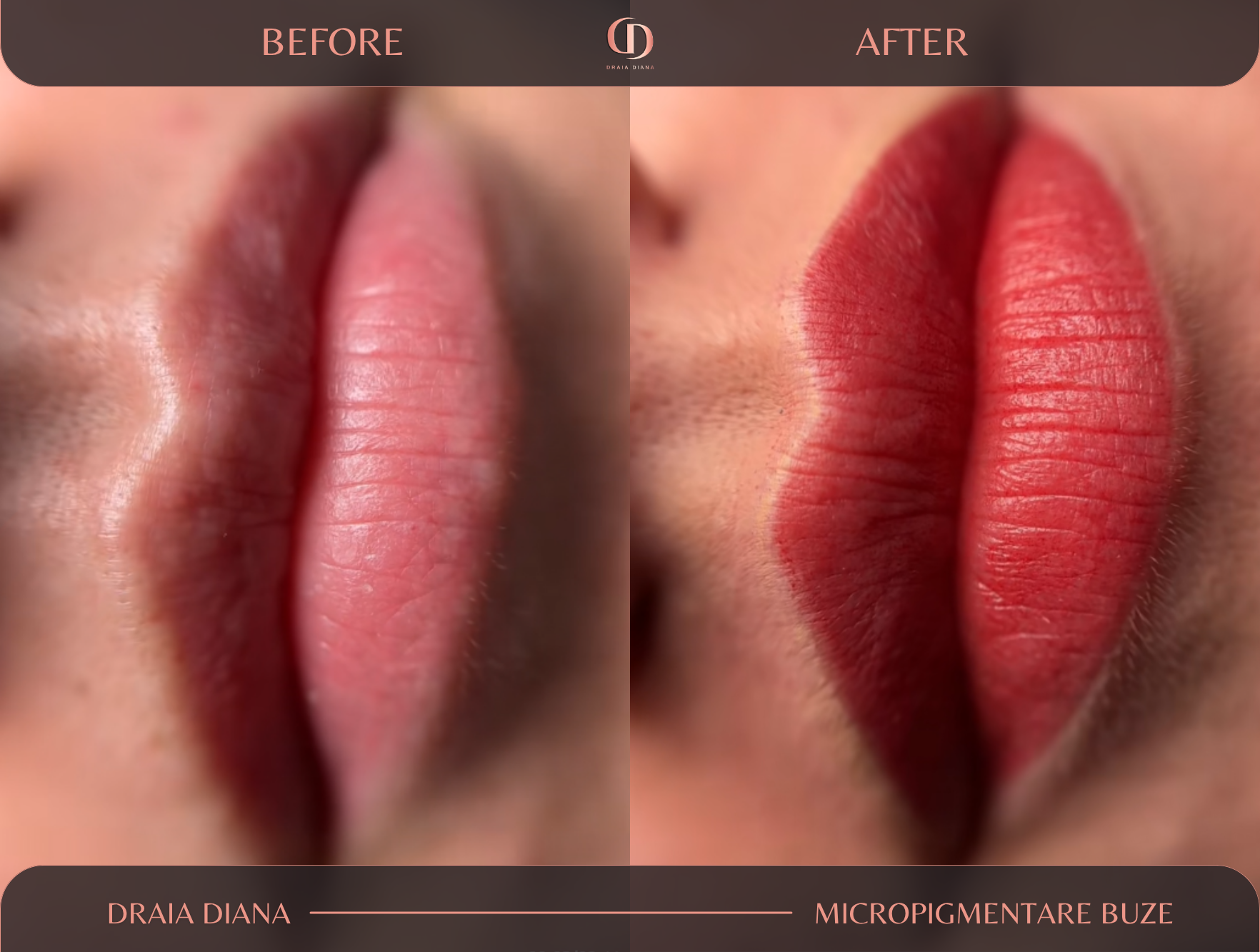 micropigmentare-buze-before_after-2.png