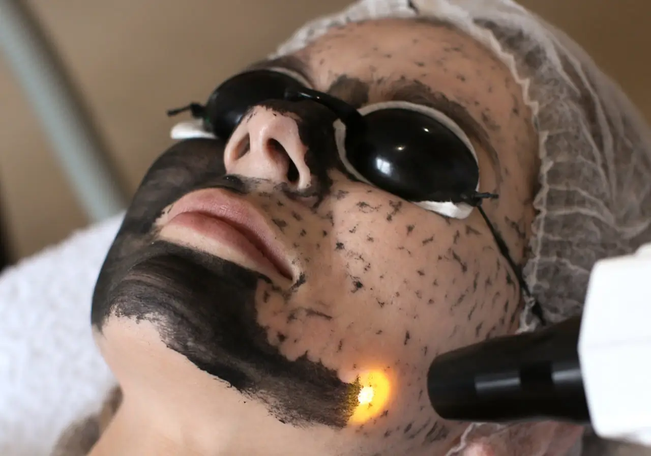 Carbon Peeling Apahida Cluj | Hollywood Peel Facial | Draia Diana Beauty Studio